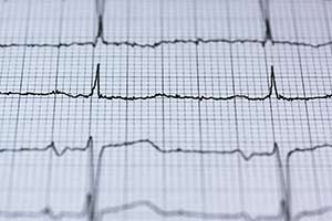 Health Data in ZIP Code 08071